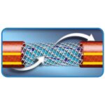 MANGUEIRA NTS ANTITORCAO EM PCV PARA JARDIM DE 1/2, COM 15 METROS TRAMONTINA - Imagem 2